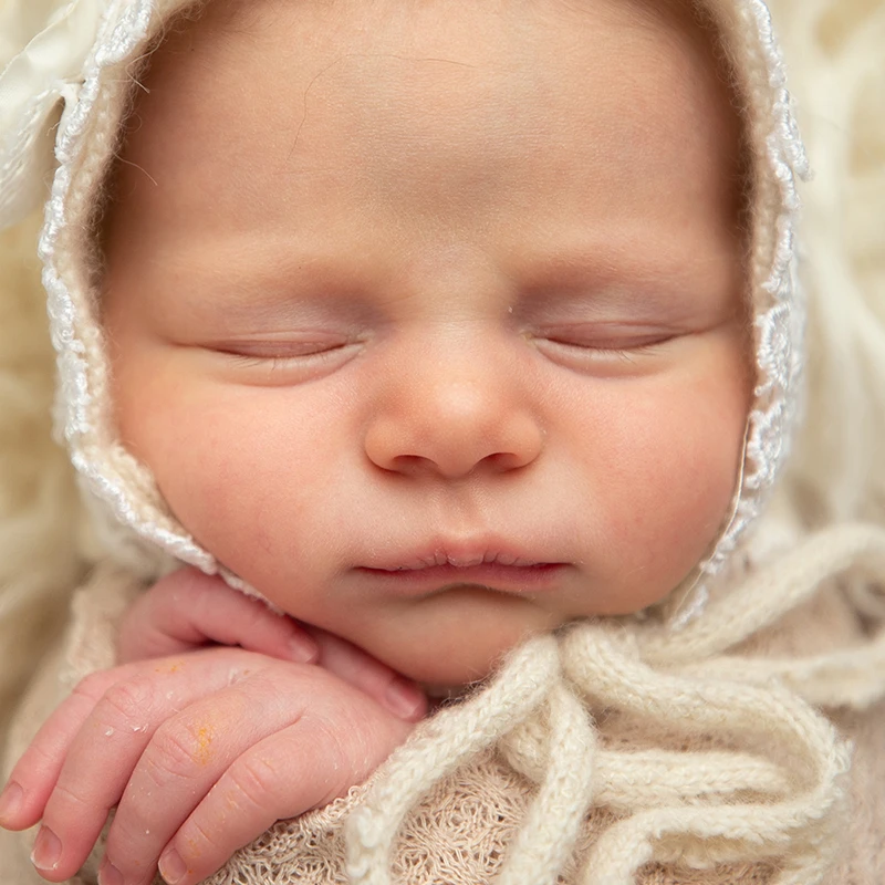 Unedited photo of sleeping baby showing spots and natural texture.